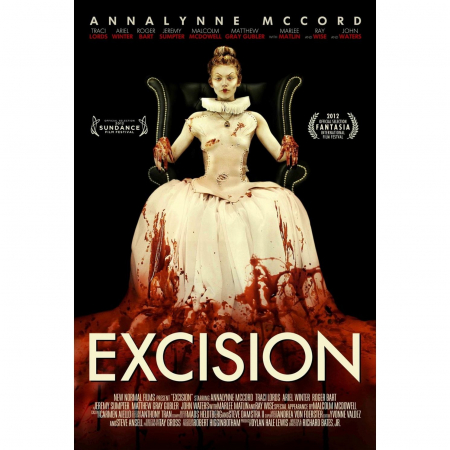 Excision